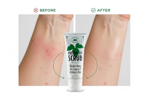 Outdoor Hands Poison Ivy Scrub - 2 oz Urushiol Remover & Rash Relief Wash