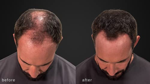 LUXE Hair Building Fibers Dark Brown - Thickening Fibers