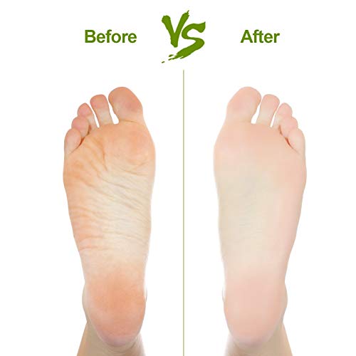 2PCS Natural Pumice Stone Foot & Hand Callus Remover - Lava Pedicure Tool Set