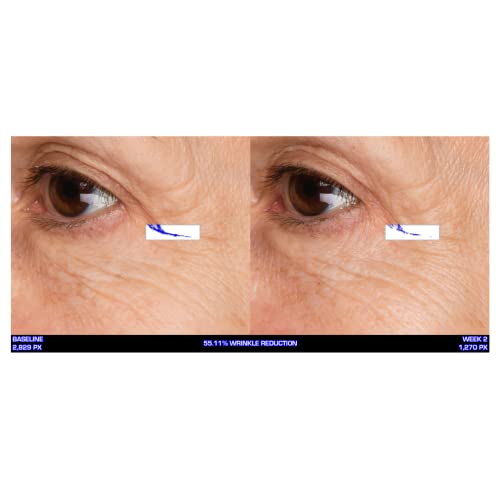 Serious Skincare - Ultra-Mare Pure Marine Infusion Revitalizing Eye Cream - Peptides - Skin Renewing - Encourages Collagen Production - Helps Reduce Wrinkle Depth - 0.5 oz