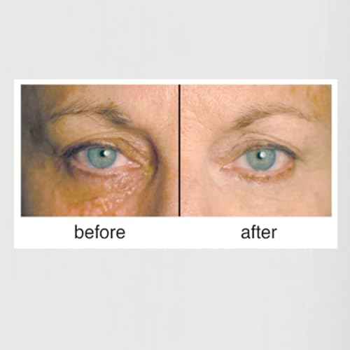 Clientele Peptide Wrinkle Concealer Compact Neutral