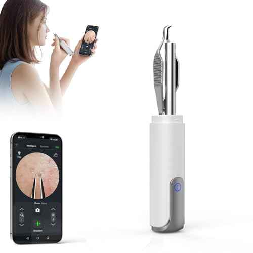 Blackhead Removal Tweezer with 1080p Camera, Ultimate Precision: Blackhead Removal with Camera - Perfect for Delicate Tasks! - - Eyebrow Tweezer, Pull White Hair (White)