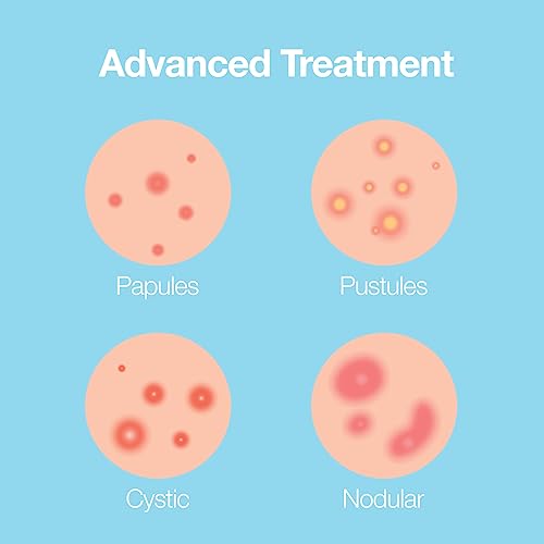 Saplaya K-Beauty Ance Care Hydrocolloid Patches For Acne Pimple Care 100% Hydrocolloid Acne Spot Healing Patch