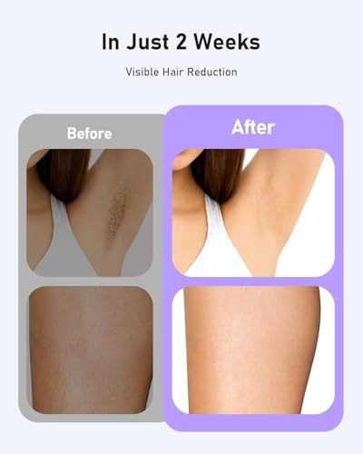 IPL Hair Removal Device for Full Body, Painless At-Home Laser System, 5.2cm² Window, 2 Week Results, Purple