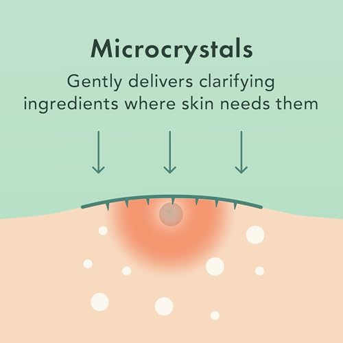 Rael Pimple Patches, Miracle Microcrystal Spot Cover - Hydrocolloid Acne Pimple Patch with Tea Tree Oil, Early Stage Zits and Blemish, Korean Skin Care (36 Count)
