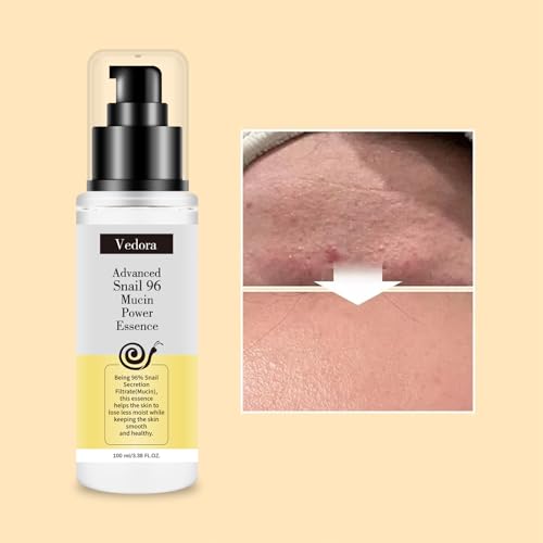 Vedora Snail Mucin 96% Hydrating Essence Serum 100ml