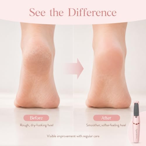 Electric Callus Remover for Feet - Nuve Silk 3 Pro 2-Speed Foot File
