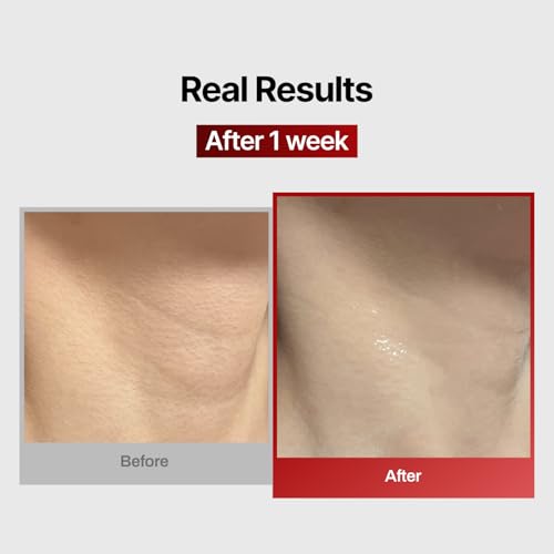 MEDITHERAPY Wrinkle-fit Neck Mask & Wrinkle-fit Face Mask + Facial Roller - Neck Wrinkle Patches, Neck Firming and Tightening Korean Deep Collagen Mask - Mesh Sheet Mask for Lifting Sagging Skin