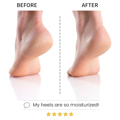 Codi New York Lavender Moisturizing Foot Mask Socks for Dry Feet - 6 Pairs