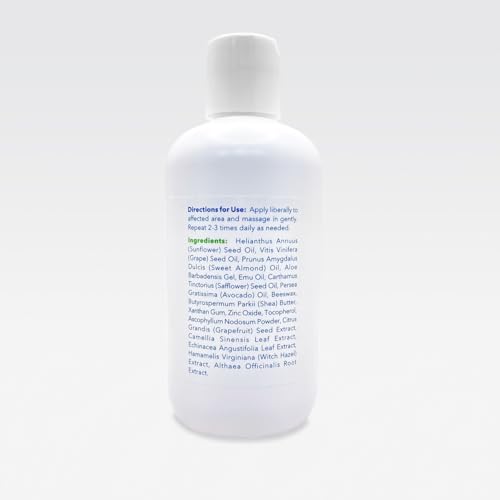 Emu Oil Infused Hand Lotion ? Deep Moisturizing Cream for Dry & Cracked Hands Skin Relief ? Perfect for Women, Men, and Travel | Natural Lotion with Shea Butter and Natural Oils - 8 oz