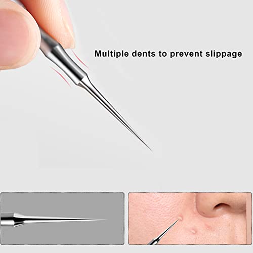 Stainless Steel Blemish & Blackhead Remover Tool
