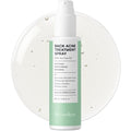 BellamiLuxx Back Acne Spray with 2% Salicylic Acid