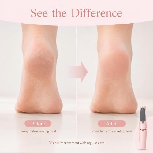 Electric Callus Remover for Dry Heels - 2 Speeds, Rechargeable, Pink