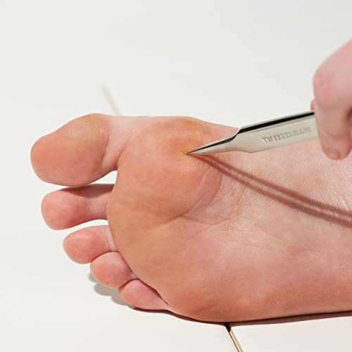 Tweezerman Stainless Steel Ingrown Hair Splintertweeze for Women and Men,(Pack of 2)