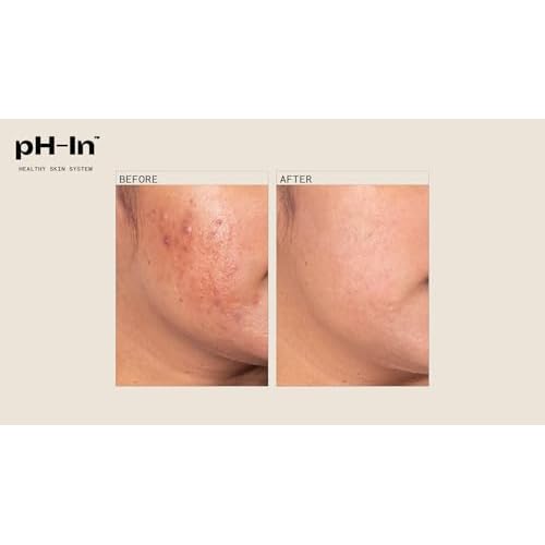 pH-In 3 Step Healthy Skin System