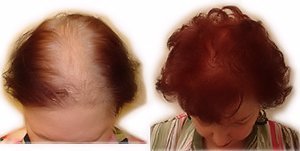 Finally Hair Building Fibers Refill Dark Brown 56g
