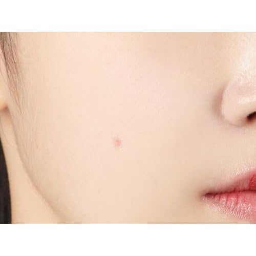 JMsolution Heartleaf Acne Pimple Patch 88EA- Hydrocolloid Slim Fit Acne Patches with Heartleaf, Tea Tree Oil, Centella Extract - 2 Size S (6 dots), M (5 dots) for Fast Healing and Protection