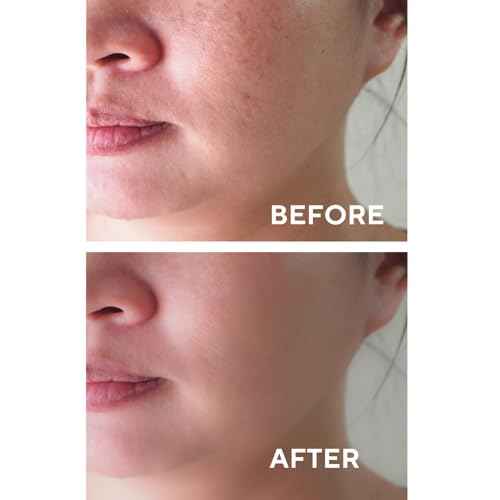 The Ceel Facial Peeling Serum With 10% AHA 2% BHA, Saliscylic Acid Serum for Blemishes, Chemical Peel at Home, Glycolic Acid Peel With Hyaluronic Acid,AHA and BHA, 1.00 fl.oz (30 ml)