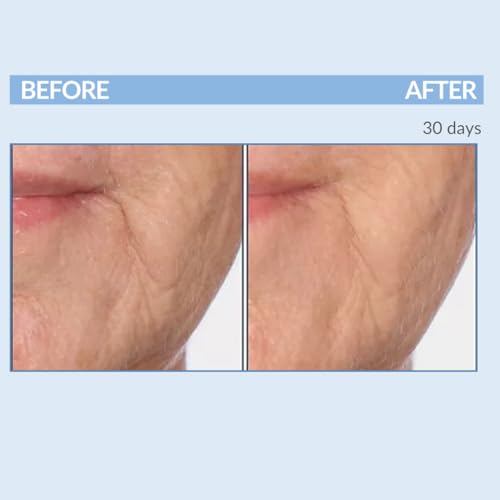 Serious Skincare Vitamin A Force XR Retinol Face Serum Concentrate, Micro Exfoliate & Resurface for Radiant Skin, for Lines, Wrinkles, Pore Minimizer, Anti-Aging 1 Oz. (Pack of 2)