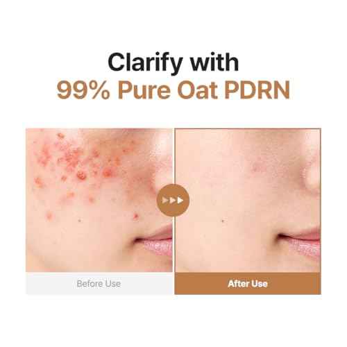 PURITO Oat PDRN Gentle Refining Toner 200 mL 6.76 fl.oz, Korean Oat Exfoliating Toner 99% Pure Oat PDRN, Hydrating & Clarifying Formula for Acne-Prone Skin, Vegan, Non-Comedogenic, Gentle Daily Use