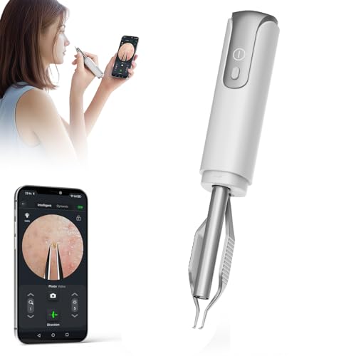 Blackhead Removal Tweezer with 1080p Camera, Ultimate Precision: Blackhead Removal with Camera - Perfect for Delicate Tasks! - - Eyebrow Tweezer, Pull White Hair (White)