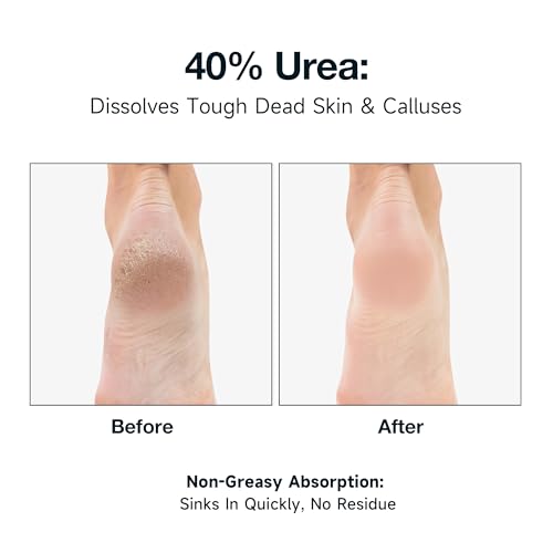 NOVAL 40% Urea Foot Cream with 2% Salicylic Acid - 8.8 OZ