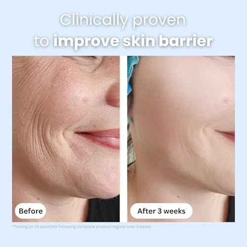 Manuka Honey 45+ MGO & Bee Venom Day Cream | 100% Natural Firming Anti-Wrinkle Face Moisturizer with Hyaluronic Acid & Vitamin C | 2oz