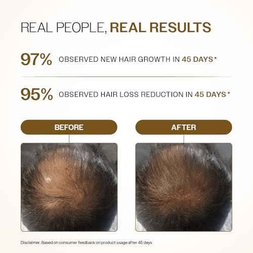 Bare Anatomy Advanced Hair Density Roll-On Serum - 25ml