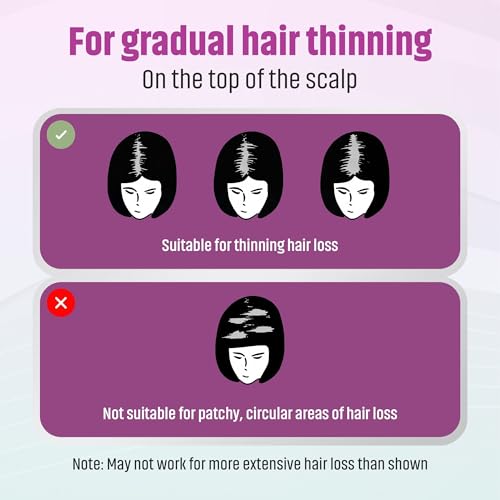 Minoxidil 2% Hair Regrowth Solution for Women | 2 Fl Oz