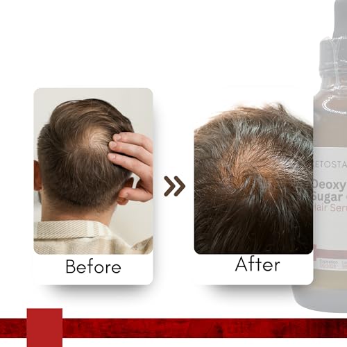 Ketostat 2-Deoxy-D-Ribose Scalp Gel 110ml | Topical Formula