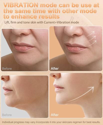 RF Skin Tightening Device 6-in-1 Face Beauty Tool