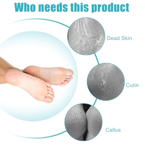 4-in-1 Foot File Callus Remover - 2 Pack Pedicure Foot Scrubber & Brush