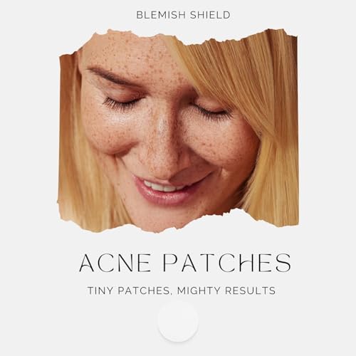 Acne Patches - Hydrocolloid Pimple Patches 72 count - Gently absorbs pus, oil and dirt from pimples in 6-8 hours