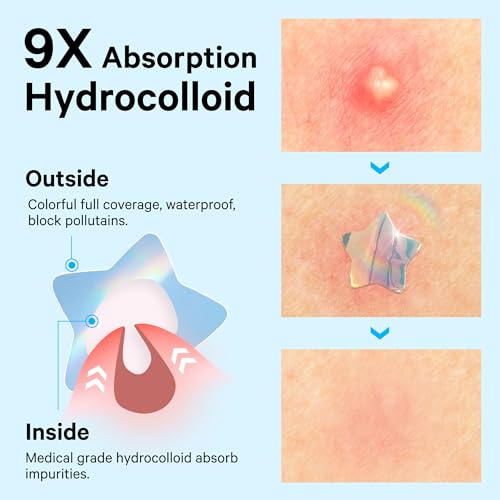 Sosky Hologram Acne Patches, Hydrocolloid Pimple Stickers with Salicylic Acid, 48 Count