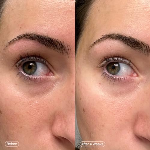 Topicals Faded Under Eye Patches - Dark Circle & Puffiness Reducer