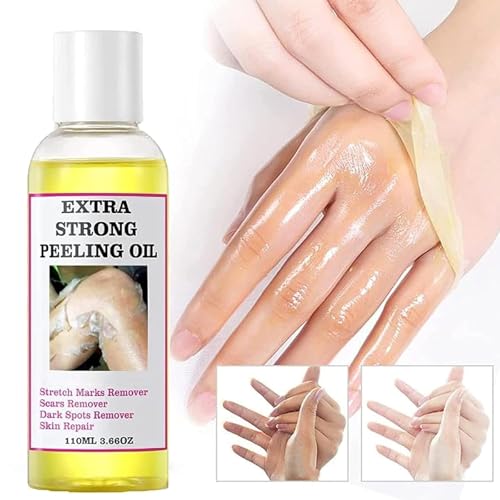 Yellow Peeling Oil for Dark Skin, Extra Strong Peeling Oil, Natural Formula Exfoliating Peels Solution for Face, Body, Hands and Foot Dead Skin Remover (110ml)
