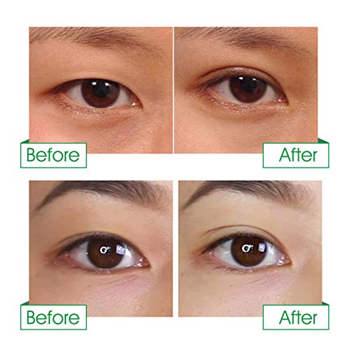 656 Pcs Invisible Slim Double Eyelid Tapes - Waterproof & Breathable