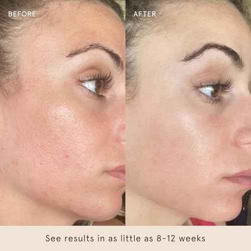 Barefaced Liquid Gold 1 Fl Oz - 15% Vitamin C Serum with Hyaluronic Acid & Vitamin E for Anti-Aging, and Hydration, Antioxidant Formula, Reduces Dark Spots, Acne & Wrinkles