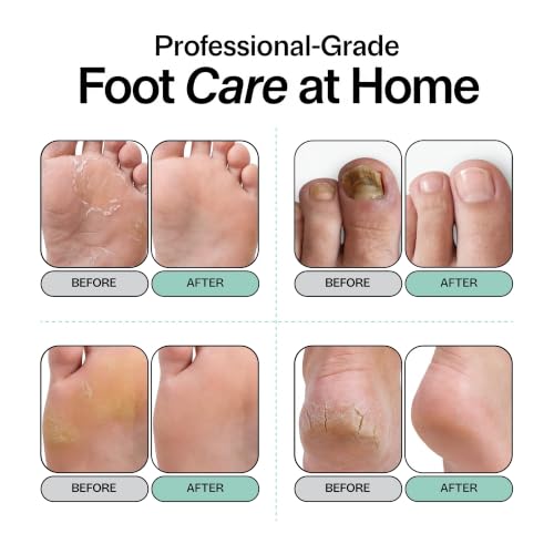Tea Tree Oil Foot Soak with Epsom Salt for Calluses & Dry Feet - 16 oz