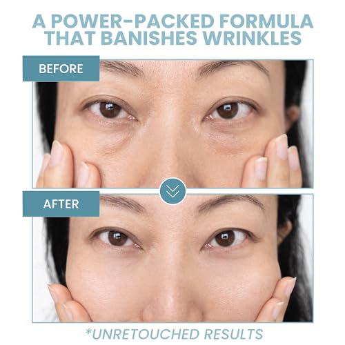 Eva Naturals Eye Gel for Dark Circles, Bags & Puffiness