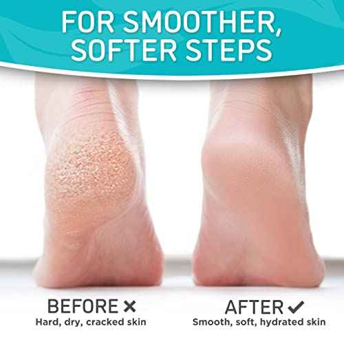 Dermora Soft Touch Exfoliating Foot Peel Mask ? Pack of 2 - For Dry, Cracked Heels, Calluses & Baby Soft Skin - Peppermint - Exfoliating Foot Peeling Mask