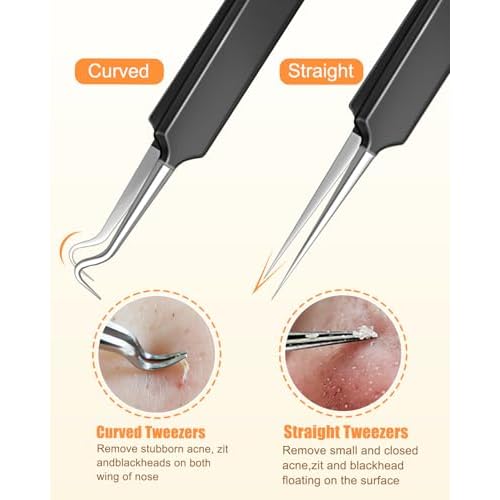 MORGLES Tweezers Set for Men, 10 in 1 Professional Eyebrow Tweezers Kit with Razor, Scissors and Blackhead Remover Tools with Travel Bag, Grooming Beauty Set (Black)