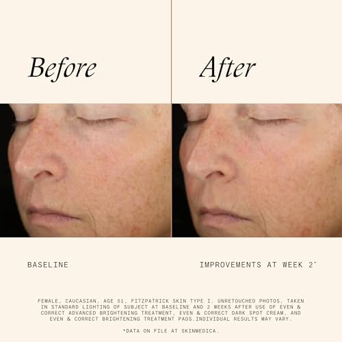 SkinMedica Even & Correct Brightening Treatment Pads For Face Exfoliating, 10% Glycolic Acid Pads That Are Retinol-Free, Alcohol-Free and Hydroquinone-Free, 60 Ct