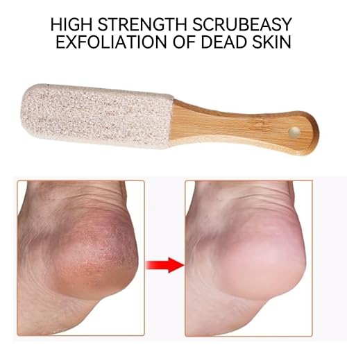 2-Pack Professional Foot File & Pumice Stone Callus Remover with Handle