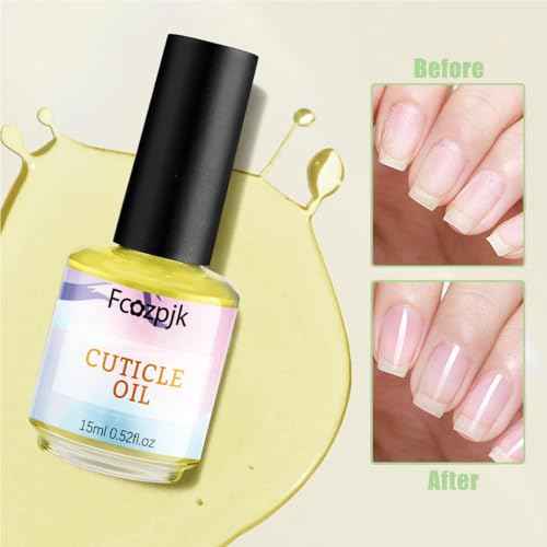 Fcozjpk Nail Dehydrator and Primer with Gel Base & Top Coat Set Cuticle Oil, 5PCS Nail Prep Kit for Acrylic and Gels Nail Polish No Wipe Gel Top Coat Manicure Bonder Liquid Nails Tech Must-have Set