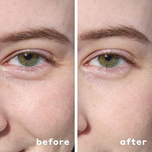 Mario Badescu Hydrogel Under Eye Patches (30 Pairs) ? Hydrating Eye Masks for Puffy Eyes, Dark Circles, Fine Lines, with Hyaluronic Acid & Niacinamide, Soothing & Plumping