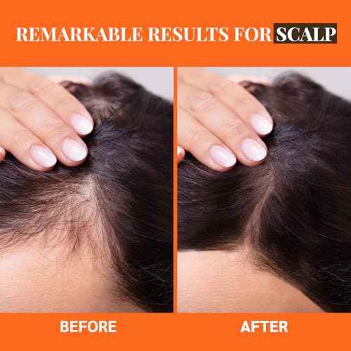 Well's Oil Batana Oil | 4 fl. oz. | 100% Natural Organic Raw Batana from Honduras | Dr. Sebi Approved | Strengthens, Hydrates & Nourishes | For All Hair Types (4 fl. oz. / 118 ml)