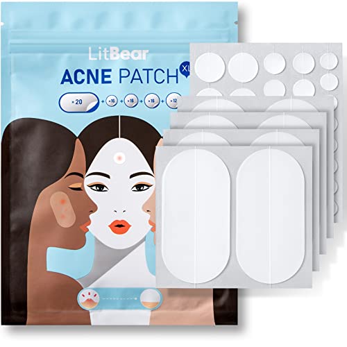 LitBear Large Acne Pimple Patches, 5 Sizes 80 Patches for Large Breakouts, Acne Patches for Face, Chin or Body, Acne Spot Patch with Tea Tree & Calendula Oil, Hydrocolloid Bandages for Acne Skin