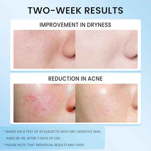 5X Ceramide Barrier Moisturizer Face Cream, With Ceramide Hyaluronic Acid Centella Collagen Hydration Relief Redness Reducing Ultra Repair Cream for All Skin Type Sensitive Skin 1PC