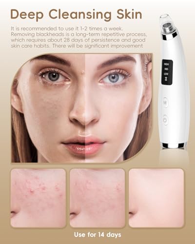 Blackhead Remover Pore Vacuum with 5 Probes & 3 Suction Levels